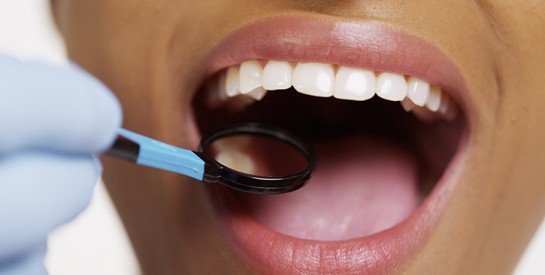 Hygiène bucco dentaire: le plombage, cause de prostate chez les hommes et d`infertilité chez la femme