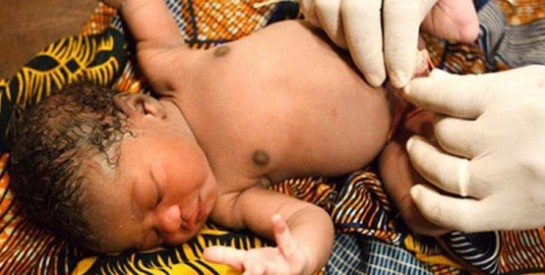 Comment prendre soin du cordon ombilical du nouveau-né ?