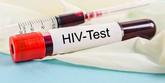 Atteinte du VIH, elle révèle son astuce pour empêcher à son mari de contracter le virus