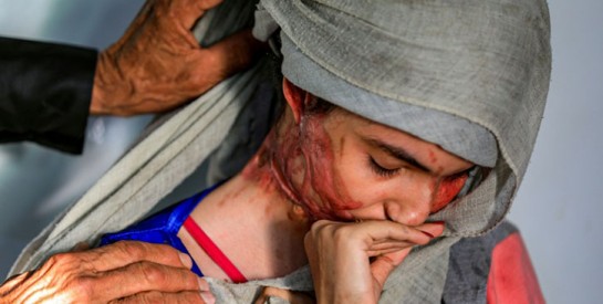 Défigurée à l'acide, Al-Anoud, 19 ans, visage des femmes brutalisées au Yémen