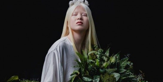 Une albinos abandonnée lorsqu'elle était bébé est devenue mannequin pour Vogue