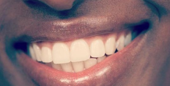 5  aliments-remèdes pour les dents blanches