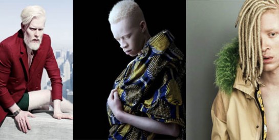 Ces 3 mannequins albinos ont conquis la mode