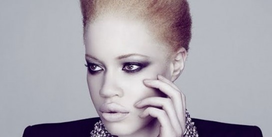 Diandra Forrest, premier mannequin albinos à devenir égérie