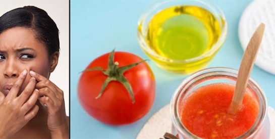 7 masques à la tomate pour prendre soin de peau