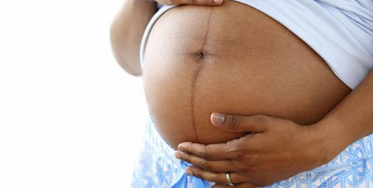 Tout savoir sur la ligne brune sur le ventre pendant la grossesse
