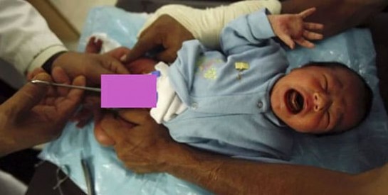 La circoncision des garçons nouveau-nés : de l`information pour les parents