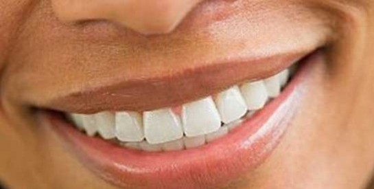 Du vinaigre pour détartrer ses dents facilement à la maison