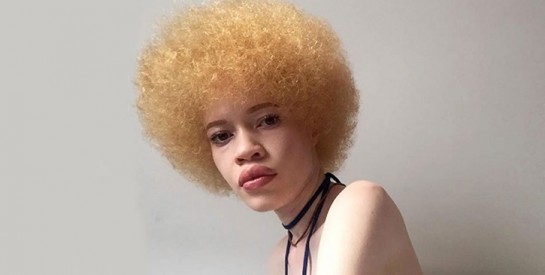 Diandra Forrest, premier mannequin albinos à devenir égérie