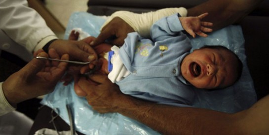 La circoncision : tout savoir sur la circoncision du bébé