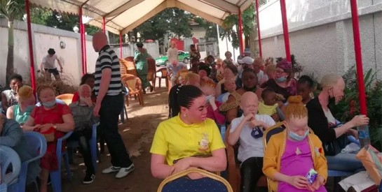 Congo-B: une ONG lance une campagne de traitement des cancers de la peau pour albinos