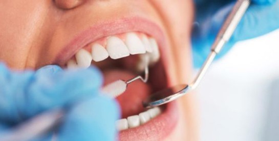 Comment détartrer ses dents soi-même à domicile?