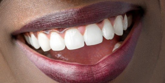 Limage de dents : cette tendance DANGEREUSE inquiète les dentistes !