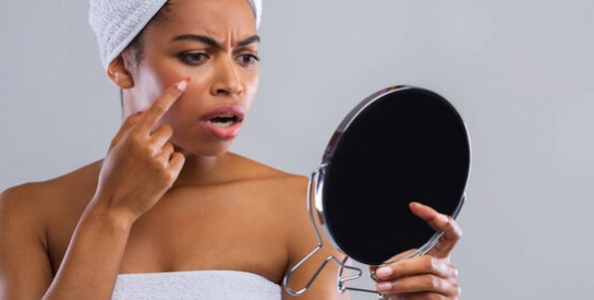 Boutons de stress : sur le visage ou sur le corps, que faire ?