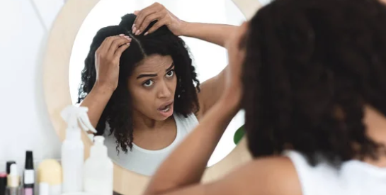 Produits capillaires : "Je suis restée des jours sans voir, à cause d'une pommade pour cheveux"