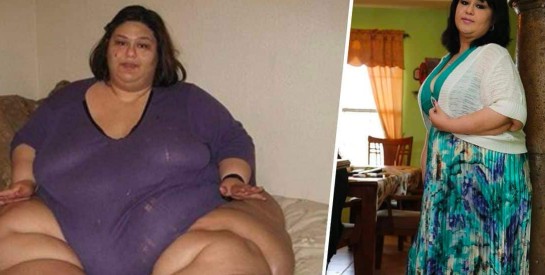 La femme la plus grosse au monde a perdu 400 kg, elle ne fait plus que 90 kg (photos)