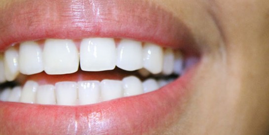 Le détartrage : un soin indispensable à la santé de nos dents