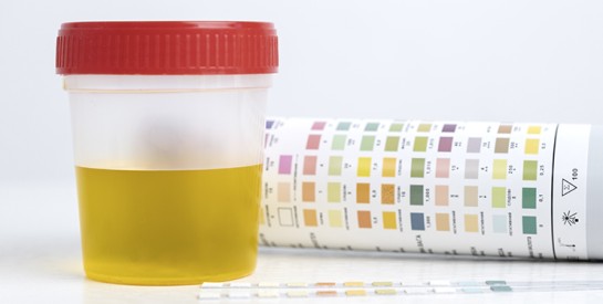 Ce que nos urines disent de notre santé