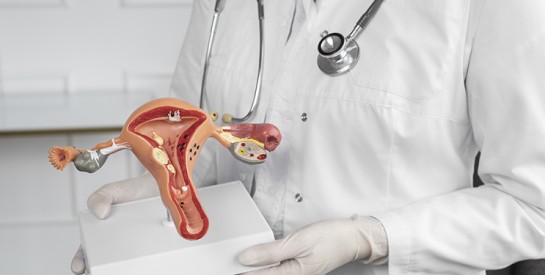 Fibromes utérins : comprendre, repérer et agir face à un trouble encore trop négligé