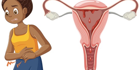 Kystes ovariens et fertilité : comprendre les liens pour mieux agir
