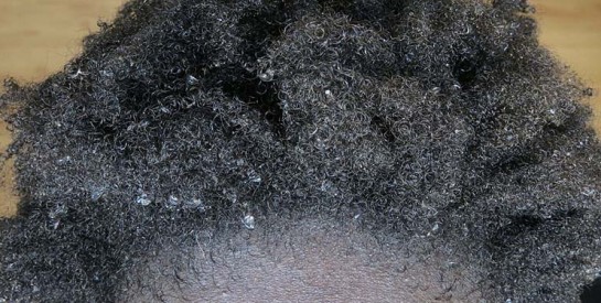 Le cuir chevelu : Les gestes et soins indispensables pour une base saine et la pousse.