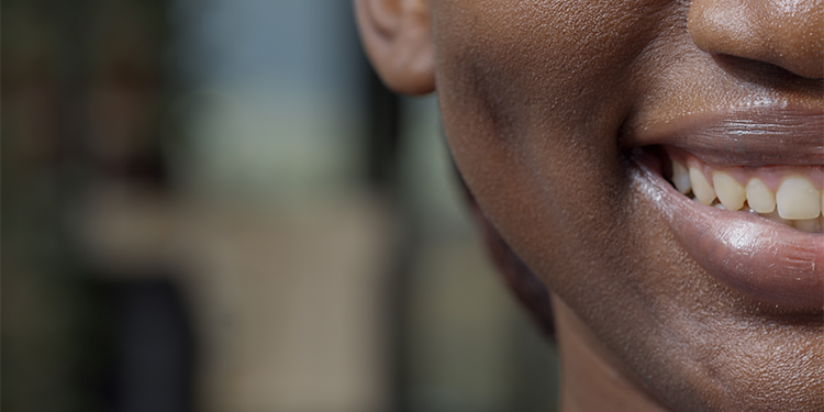 Taches de café sur les dents : comment retrouver un sourire plus éclatant naturellement