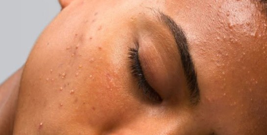 Votre peau paraît plus terne ces derniers temps ? Regardez aussi du côté de vos habitudes quotidiennes