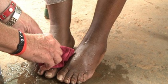 Comment se débarrasser d’un cor au pied