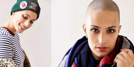 Atteinte d’un cancer, cette jeune femme a réalisé son rêve en devenant mannequin