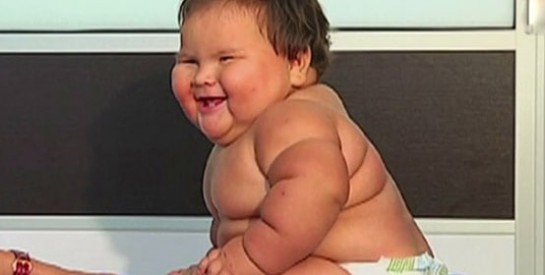 Un bébé colombien en grave état d’obésité