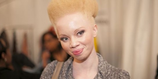 Thando Hopa, mannequin sud-africaine révélée par sa peau albinos
